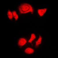 Nucleophosmin (Phospho-T199) Rabbit Polyclonal Antibody