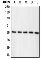 Nucleophosmin (Phospho-T234) Rabbit Polyclonal Antibody