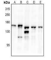 TRK B (Phospho-Y516) Rabbit Polyclonal Antibody