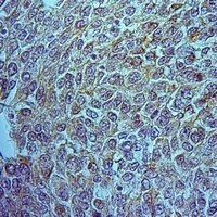 OAT Rabbit Polyclonal Antibody
