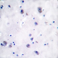 Mu Opioid Receptor (Phospho-S375) Rabbit Polyclonal Antibody