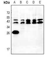 Orosomucoid 2 Rabbit Polyclonal Antibody