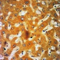 Orosomucoid 2 Rabbit Polyclonal Antibody