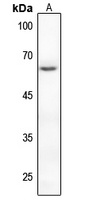 PAK2 (Phospho-S20) Rabbit Polyclonal Antibody