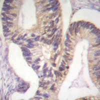 PAK2 (Phospho-S20) Rabbit Polyclonal Antibody