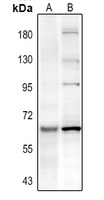 PAK3 (Phospho-S154) Rabbit Polyclonal Antibody