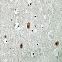 PAK3 (Phospho-S154) Rabbit Polyclonal Antibody