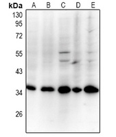 PCNA Antibody [KO/KD Validated]