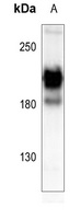 PDGFR alpha Rabbit Polyclonal Antibody