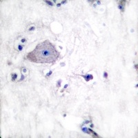 PDGFR alpha Rabbit Polyclonal Antibody