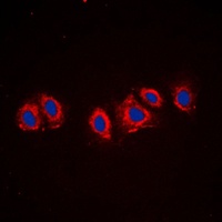 PDGFR alpha Rabbit Polyclonal Antibody