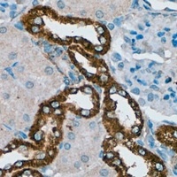 PDGFR beta Antibody