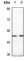 PDK1 Rabbit Polyclonal Antibody