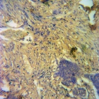 PDK1 Rabbit Polyclonal Antibody