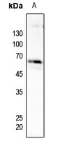 PFKFB2 (Phospho-S483) Rabbit Polyclonal Antibody