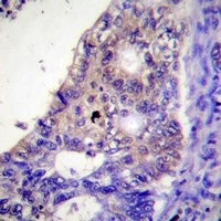 PFKFB2 (Phospho-S483) Rabbit Polyclonal Antibody