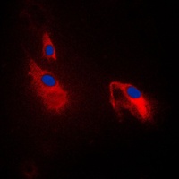 PFKP Rabbit Polyclonal Antibody