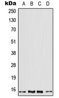 Profilin 2 Antibody