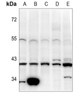 Pepsinogen C Rabbit Polyclonal Antibody