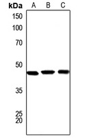 Serpin A1 Rabbit Polyclonal Antibody