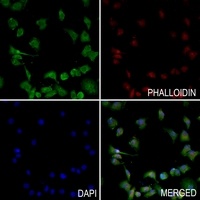 Serpin A1 Rabbit Polyclonal Antibody