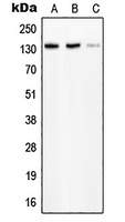 PLC beta 2 Rabbit Polyclonal Antibody