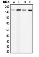 PLC beta 3 (Phospho-S537) Rabbit Polyclonal Antibody