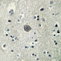 PLC beta 3 (Phospho-S537) Rabbit Polyclonal Antibody