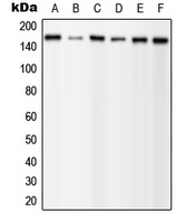 PLC gamma 1 (Phospho-Y1253) Rabbit Polyclonal Antibody