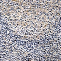 PLC gamma 2 (Phospho-Y1217) Rabbit Polyclonal Antibody