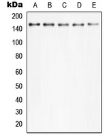 PLC gamma 2 (Phospho-Y753) Rabbit Polyclonal Antibody