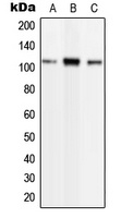 Phospholipase D2 (Phospho-Y169) Rabbit Polyclonal Antibody