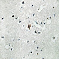 Phospholipase D2 (Phospho-Y169) Rabbit Polyclonal Antibody