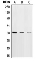 DNA Polymerase beta Rabbit Polyclonal Antibody