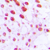 DNA Polymerase beta Rabbit Polyclonal Antibody