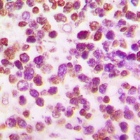 OCT2 Rabbit Polyclonal Antibody