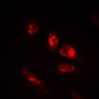 OCT2 Rabbit Polyclonal Antibody