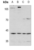 ARD1 Rabbit Polyclonal Antibody
