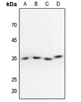 PPP2CA (Phospho-Y307) Rabbit Polyclonal Antibody