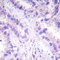 PPP2CA (Phospho-Y307) Rabbit Polyclonal Antibody