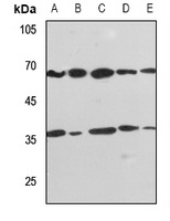 PPP2R1B Rabbit Polyclonal Antibody