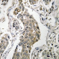 PPP2R1B Rabbit Polyclonal Antibody