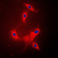 PPP2R1B Rabbit Polyclonal Antibody