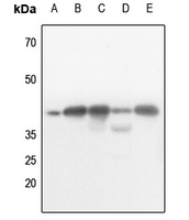 AMPK beta 1 (Phospho-S182) Rabbit Polyclonal Antibody