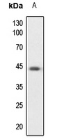 PKA C alpha/beta/gamma Antibody