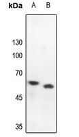 PRKAR2B Rabbit Polyclonal Antibody