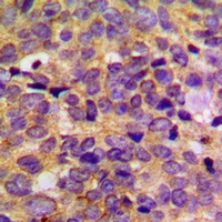 PRKAR2B Rabbit Polyclonal Antibody