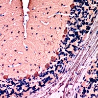 PKC gamma Rabbit Polyclonal Antibody