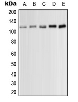 PKC mu (Phospho-S910) Rabbit Polyclonal Antibody