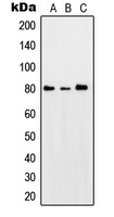 PKC theta (Phospho-S676) Rabbit Polyclonal Antibody